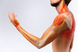 Nerve pain and sciatica physiotherapy Singapore